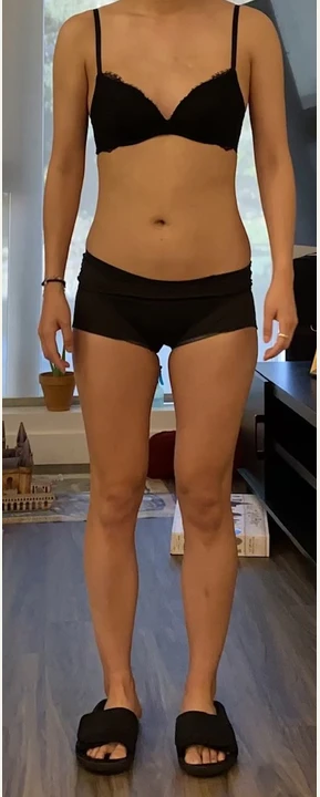 Face-cropped front-view client progress photo, after.