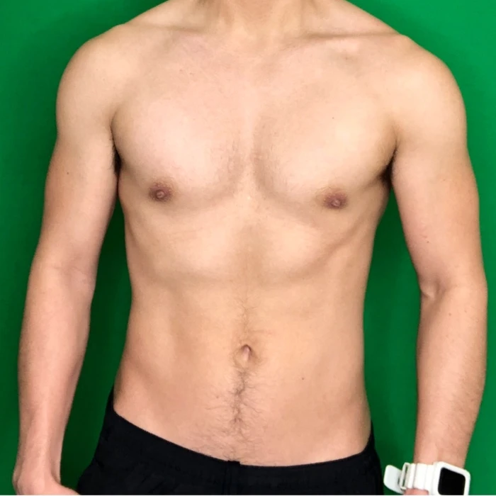 Face-cropped client progress photo, after.