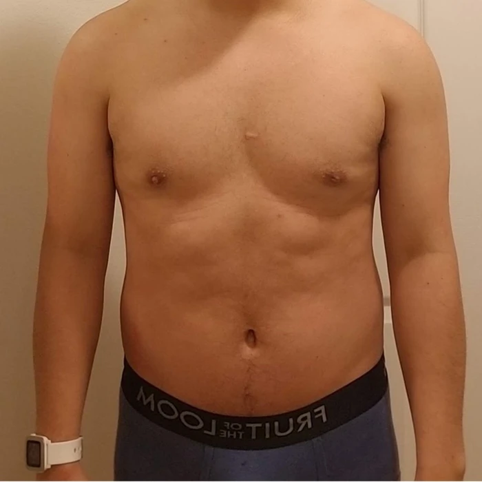 Face-cropped client progress photo, before.