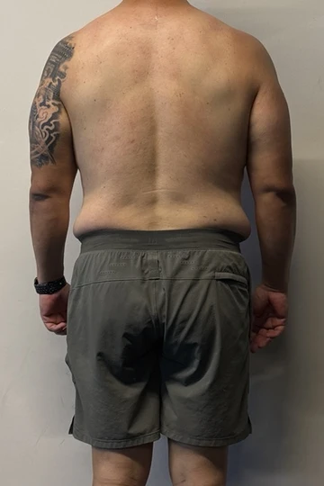 Back-view client progress photo, after.