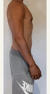 Face-cropped side-view client photo, after.